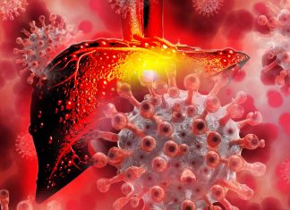 Liver injury may be associated with COVID-19 due to direct damage of the viral infection to liver cells up to 20 months after infection