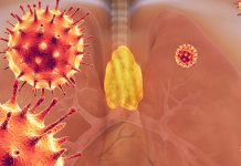 Lymphopenia: The thymus is a target of SARS-CoV-2