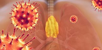 Lymphopenia: The thymus is a target of SARS-CoV-2