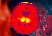 COVID-19: newborn can develop acute necrotizing encephalopathy (ANE) due to SARS-COV-2 infection