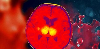 COVID-19: newborn can develop acute necrotizing encephalopathy (ANE) due to SARS-COV-2 infection