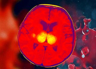 COVID-19: newborn can develop acute necrotizing encephalopathy (ANE) due to SARS-COV-2 infection