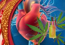 L’uso frequente di cannabis aumenta il rischio di malattia coronarica (CAD) del 34%