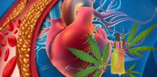 L’uso frequente di cannabis aumenta il rischio di malattia coronarica (CAD) del 34%