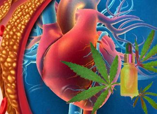 L’uso frequente di cannabis aumenta il rischio di malattia coronarica (CAD) del 34%