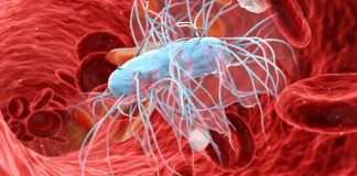 Combination of Hydrocortisone and Fludrocortisone in the Treatment of Septic Shock