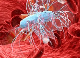 Combination of Hydrocortisone and Fludrocortisone in the Treatment of Septic Shock