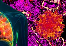 Covid-19: Innate Immune Cell Activation Causes Lung Fibrosis