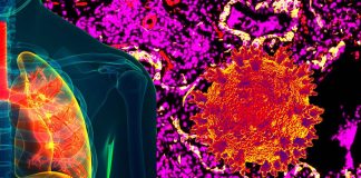 Covid-19: Innate Immune Cell Activation Causes Lung Fibrosis