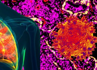 Covid-19: Innate Immune Cell Activation Causes Lung Fibrosis