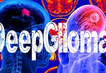 DeepGlioma: artificial-intelligence-based diagnostic screening system to streamline the molecular diagnosis of diffuse gliomas