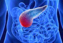 Fc-SPINK1: New potential engineered protein to treat multiple forms of pancreatitis