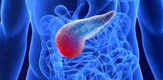 Fc-SPINK1: New potential engineered protein to treat multiple forms of pancreatitis