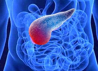 Fc-SPINK1: New potential engineered protein to treat multiple forms of pancreatitis