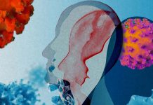 Influenza del virus SARS-CoV-2 sul disturbo bipolare