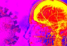 Maternal SARS-CoV-2 positivity is associate with neurodevelopmental diagnoses at 12 months among male offspring