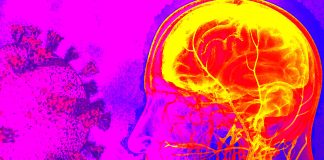 Maternal SARS-CoV-2 positivity is associate with neurodevelopmental diagnoses at 12 months among male offspring