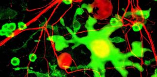 The impact of SARS-CoV-2 Spike protein on microglial purinergic signaling