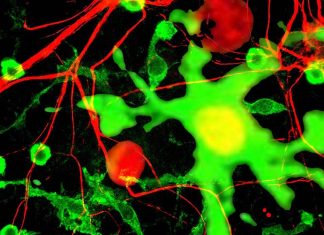 The impact of SARS-CoV-2 Spike protein on microglial purinergic signaling