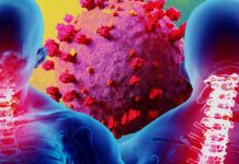 SARS-CoV-2 can be a causal factor of Phrenic Neuropathy and Diaphragmatic Dysfunction