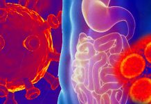 The gastrointestinal disease is another facet of the multifaceted Long Covid