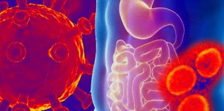The gastrointestinal disease is another facet of the multifaceted Long Covid