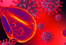 COVID-19: Hemoglobin/iron dysmetabolism is likely to be the leading process causing multiorgan disease and hypoxia