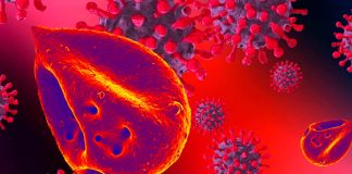 COVID-19: Hemoglobin/iron dysmetabolism is likely to be the leading process causing multiorgan disease and hypoxia
