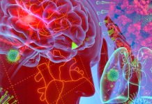 Why and what inflammatory response can be triggered by SARS-CoV-2