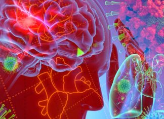 Why and what inflammatory response can be triggered by SARS-CoV-2
