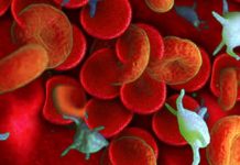 Haematological change can persist for up to 985 Days in Long COVID