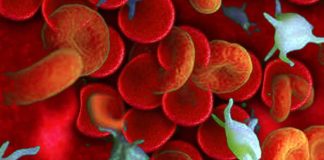 Haematological change can persist for up to 985 Days in Long COVID