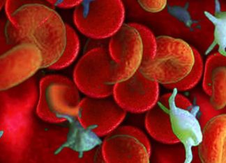 Haematological change can persist for up to 985 Days in Long COVID