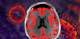 Children with ASD who have language impairment have lower gray matter volume and greater gyrification in the temporal and frontal lobes of the cerebral cortex