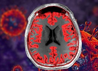 Children with ASD who have language impairment have lower gray matter volume and greater gyrification in the temporal and frontal lobes of the cerebral cortex