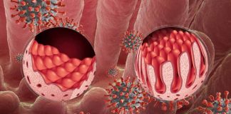 How does COVID-19 affect celiac disease?