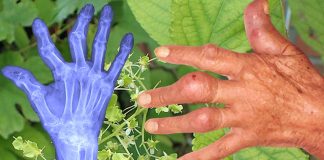 Celastrol è un candidato farmacologico principale per il trattamento dell’artrite reumatoide