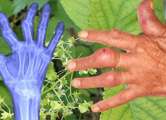 Celastrol è un candidato farmacologico principale per il trattamento dell’artrite reumatoide