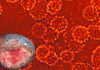 New cases of the rare sexually transmitted Donovanosis virus reported in the UK