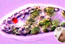 South Korean researcher have discovered that Euglena gracilis-Derived Extracellular Vesicles Enhance Skin-Regenerative Wound Healing
