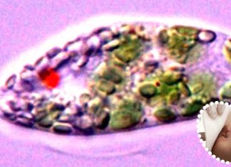 South Korean researcher have discovered that Euglena gracilis-Derived Extracellular Vesicles Enhance Skin-Regenerative Wound Healing