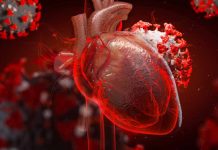 Major adverse cardiac events (MACE) are frequently diagnosed complications of COVID-19