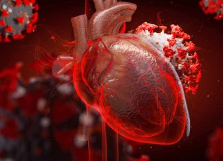 Major adverse cardiac events (MACE) are frequently diagnosed complications of COVID-19