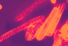 Marburg Virus hits Japan – maximum fatality rate of 88%