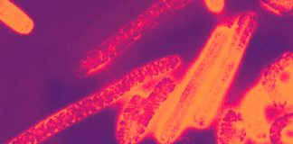 Marburg Virus hits Japan – maximum fatality rate of 88%