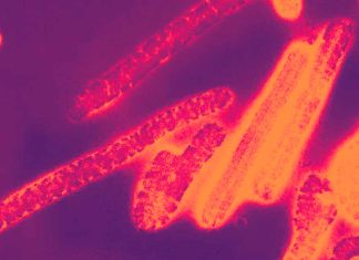 Marburg Virus hits Japan – maximum fatality rate of 88%