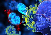 Long-Term Neurological Complications in post-COVID-19 linked to SARS-CoV-2 Spike Protein Accumulation in the Skull-Meninges-Brain Axis