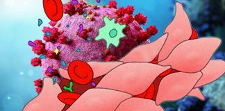 SARS-CoV-2 Spike Protein-Induced Endothelial Cell Permeability