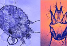 Scabies is evolving evading treatments involving Permethrin