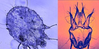 Scabies is evolving evading treatments involving Permethrin